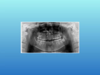 Radiografia Panorâmica Digital