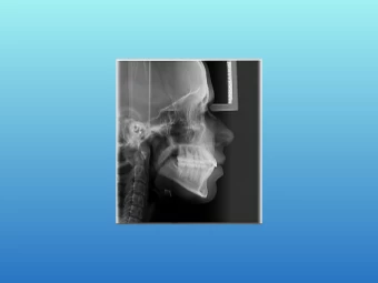 Telerradiografia Lateral Digital
