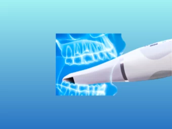 Escaneamento Intraoral