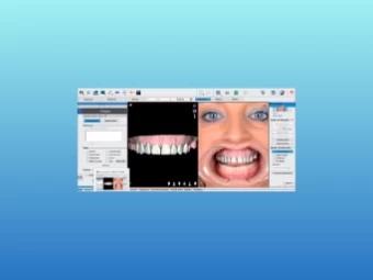 Planejamento 3D do Sorriso