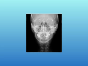 Telerradiografia Frontal Digital