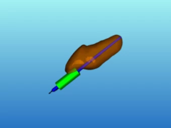 Endoguide