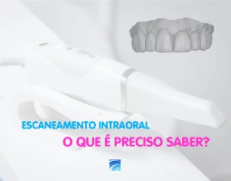 ESCANEAMENTO INTRAORAL - O QUE É PRECISO SABER?