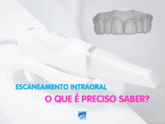 ESCANEAMENTO INTRAORAL - O QUE É PRECISO SABER?