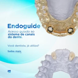 Endoguide - Você já utiliza?