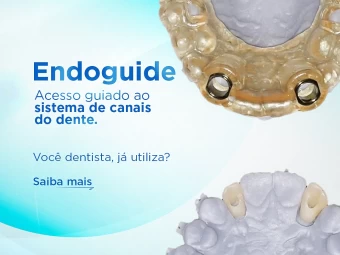 Endoguide - Você já utiliza?