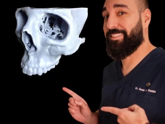 Biomodelos: A Revolução no Planejamento Cirúrgico Odontológico